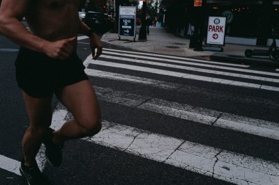 Mannen kiezen voor een implantaat tegen dunne kuiten